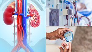 मधुमेह गुर्दे की बीमारी - Digital medical resources about diabetic kidney disease by the humanitarian medical organisation Developing Medicine - Diabetic nephropathy - Diabetic kidney disease