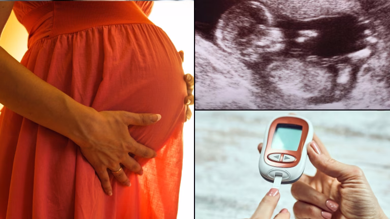 ගැබ් ගැනීම - Sinhala digital medical resources by the Humanitarian Medical Organisation Developing Medicine - Pregnancy resources