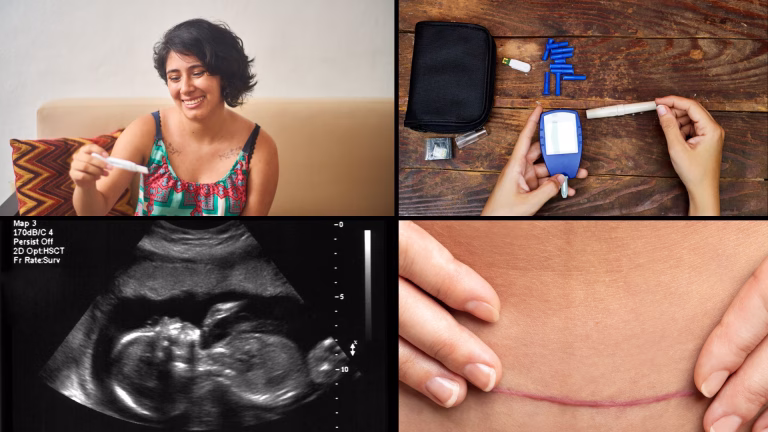 Digital medical resources in Spanish from the humanitarian medical organization Developing Medicine - pregnancy