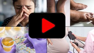 පූර්ව-එක්ලැම්ප්සියාව යනු කුමක්ද? අපගේ වෛද්‍යවරු මෙම තත්වයේ පොදු ලක්ෂණ සහ රෝග ලක්ෂණ සාකච්ඡා කරති.What is pre-eclampsia? Our doctors discuss the common signs and symptoms of this condition.