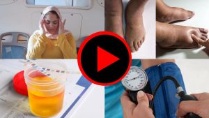 ہمارے ڈاکٹر حمل کے دوران پری ایکلیمپسیا کی عام علامات اور علامات کی وضاحت کرتے ہیں۔ Our doctors explain the common signs and symptoms of pre-eclampsia during pregnancy.