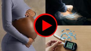 Digital medical resources by the Humanitarian Medical Organisation Developing Medicine - Caesarean section care
