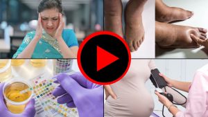 Digital medical resources by the Humanitarian Medical Organisation Developing Medicine - ਪ੍ਰੀ-ਐਕਲੈਂਪਸੀਆ ਕੀ ਹੈ? ਸਾਡੇ ਡਾਕਟਰ ਗਰਭ ਅਵਸਥਾ ਦੌਰਾਨ ਪ੍ਰੀ-ਐਕਲੈਂਪਸੀਆ ਦੇ ਆਮ ਲੱਛਣਾਂ ਅਤੇ ਸੰਕੇਤਾਂ ਬਾਰੇ ਚਰਚਾ ਕਰਦੇ ਹਨ।